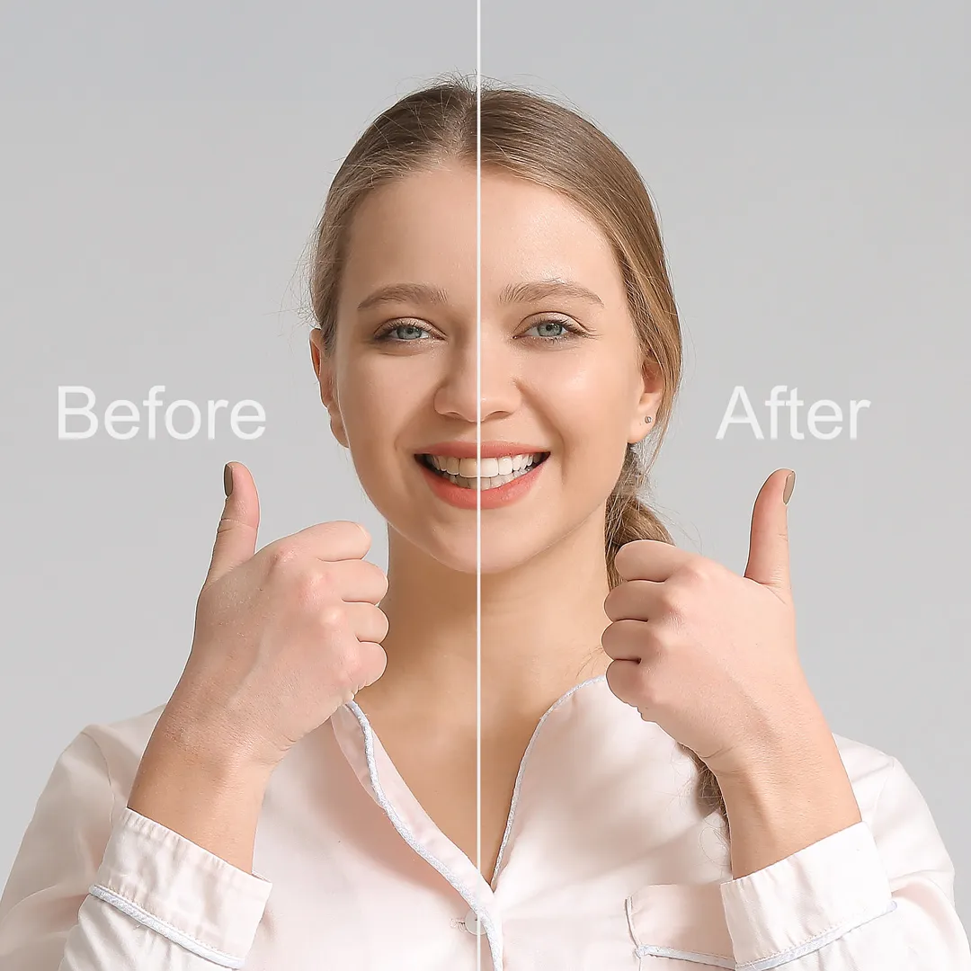 Smile Makeovers in San Diego